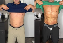 Load image into Gallery viewer, Before and after results of a male customer doing Cryo Slimming. Cryo Slimming eliminates fat instantly and permanently.